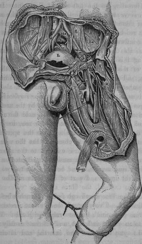 Surgical Anatomy of the Iliac and Femoral Arteries.