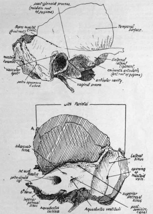 Outer and inner aspects of temporal bone