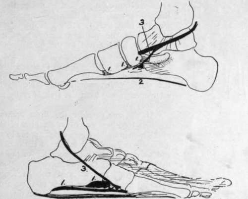 the supporting structures in the foot