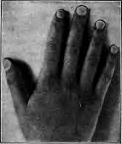 Hand with nails properly cared for.
