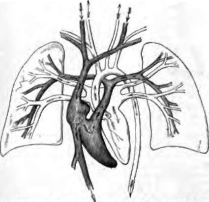 Diagram of Human Heart and Vessels. To the rides are the lungs represented 