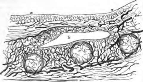 Section of an Injected Tonsil, a, a. Mucous membrane of fauces; b, a recess; c, c, c, closed follicles.