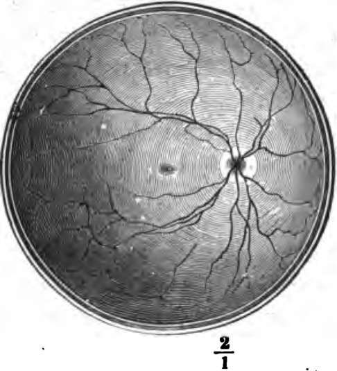 The right retina as it would be seen if the front part of the eyebaU with the lens and vitreous humor were removed.