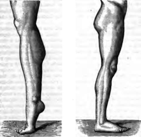 The leg in standing.