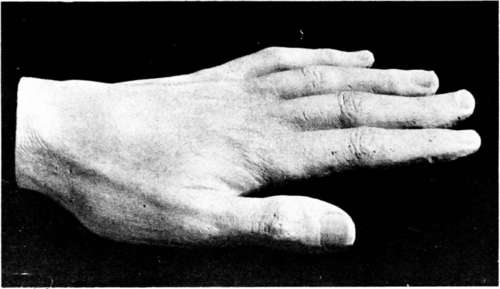 Cast Of Francis Thompson's Hand