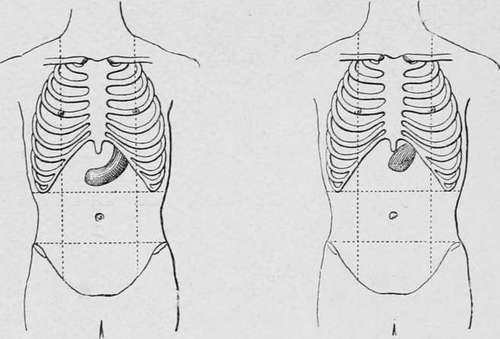 forms of tumour