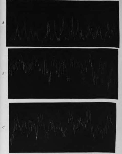 Records Of The Gastric Hunger Contractions Of A Dog