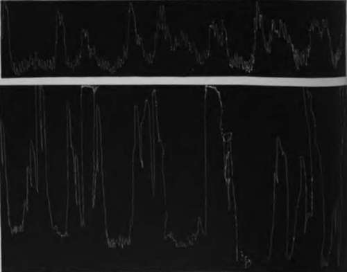 Tracing From Empty Stomach Of Dog While Normal