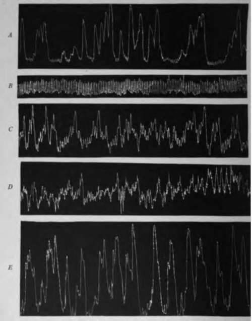 Tracings From Empty Stomach Of Dog