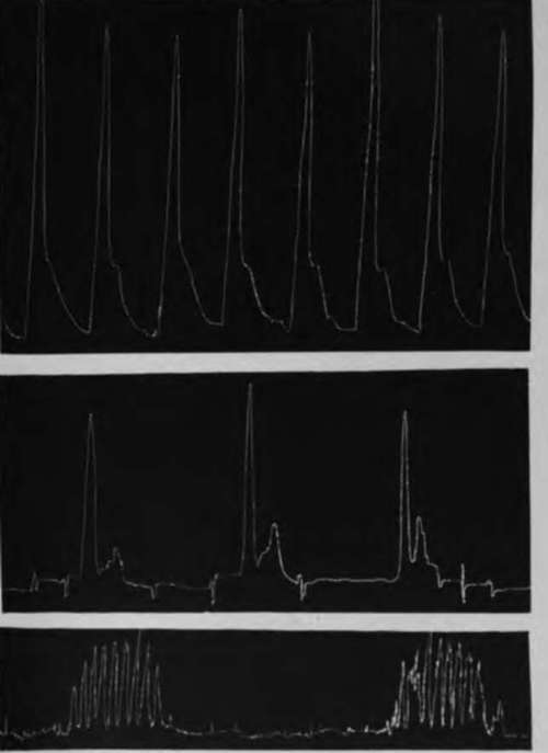 Tracings Of The Gastric Hunger Contractions Of The Empty Stomach Of The Bullfrog