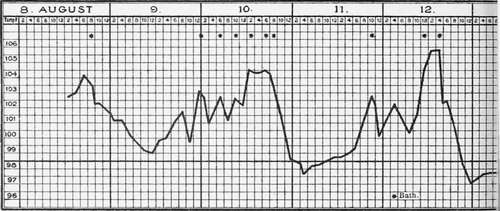 Remittent Intermittent Fever In Ordinary