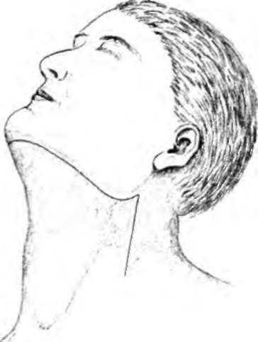 Incision when the glands are not palpably Involved
