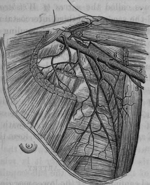 Axillary Artery, Pectoral and Deltoid Muscles removed.