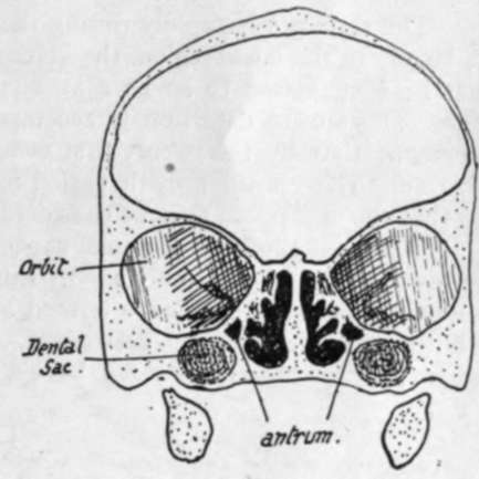 Section through foetal skull