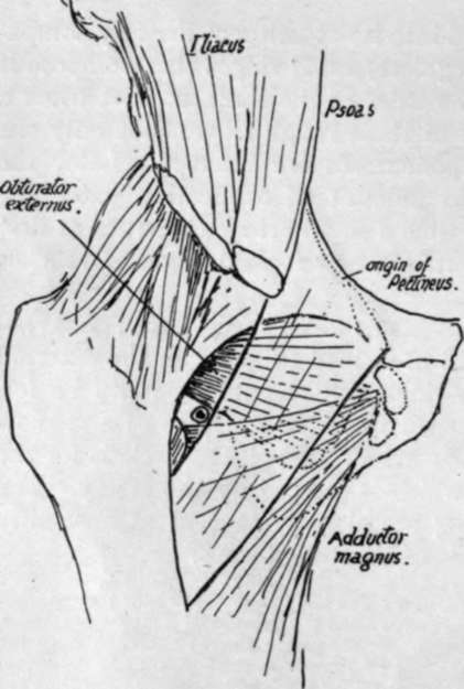 course of the internal circumflex artery