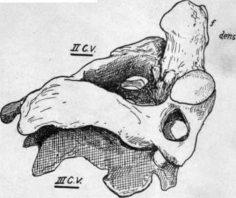 second cervical vertebra