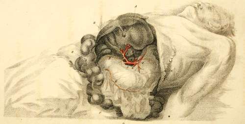 The Distribution Of The Cellic Artery