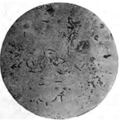 Germs of tuberculosis. Much enlarged. From a photograph.