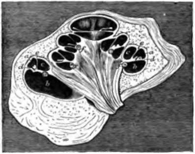 Cochlea or New born Pig, section, a, Canalis membranacea; b, scala tympani.