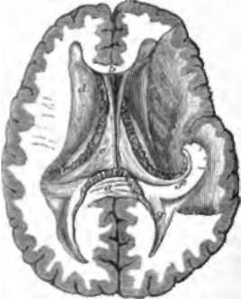 The Lateral Ventricles.