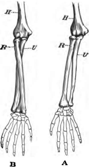 A, arm In supination; B, arm in pronation ; H, humerus; R, radius; U ulna.