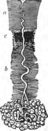 A sweat gland, d, horny layer of cuticle; c, Malpighian layer; 6, dermis.