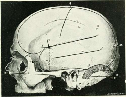 Cranio Cerebral Topography