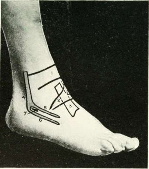The Region Of The Ankle And Foot